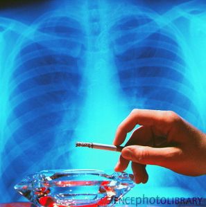 M3700079-X-ray_of_healthy_unhealthy_lungs_cigarettes-SPL