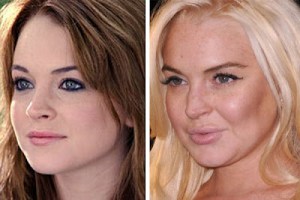 lindsay-lohan-before-after-2